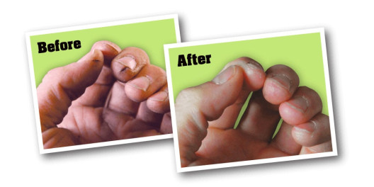 Working Hands creme fra O'Keeffe's - før og efter billede Working Hands creme fra O'Keeffe's - før og efter billede